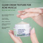 Mercilen MILD ACNE CONTROL AND OIL CONTROLTO REDUCE LINGERING MARKS