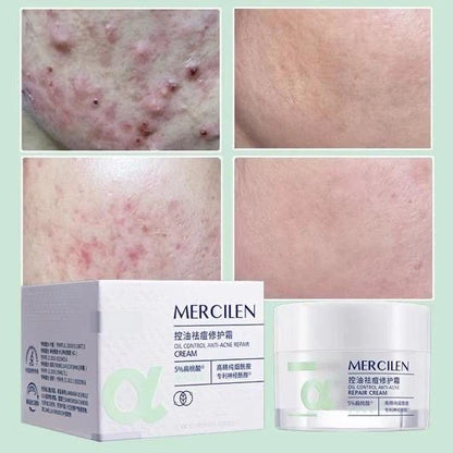 Mercilen MILD ACNE CONTROL AND OIL CONTROLTO REDUCE LINGERING MARKS